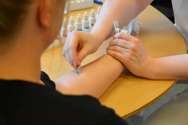 Allergy Testing
