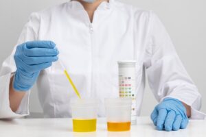 Laboratory Services for Urinalysis: