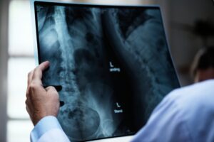 Minimally Invasive Spine Surgery